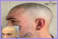 Unveiling The Truth: Steve Austin's Baldness Decoded